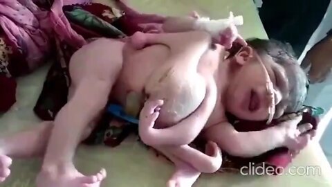 MUTANT BABIES – THE NEWEST PRODUCT OF THE MNRA KILL SHOT. MORE AND MORE WILL BE BORN DEFORMED