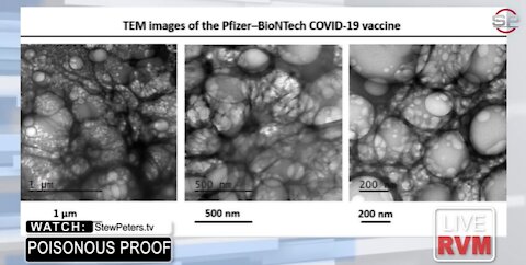 Dr. Jane Ruby: Grapheine Oxide 99% in Pfizer "vaccines"