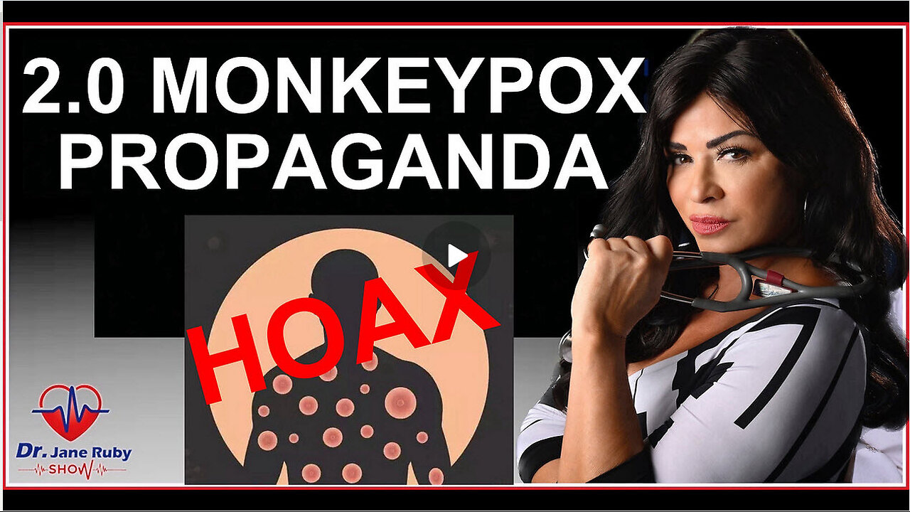 INCOMING WHO/UN MONKEYPOX (2ND) HOAX