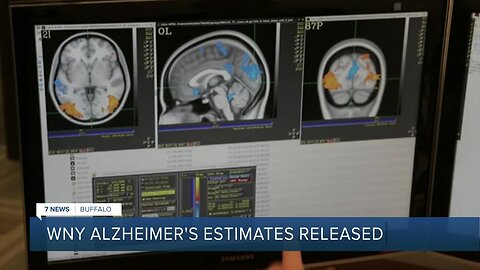 Where in Western New York is Alzheimer’s most prevalent?