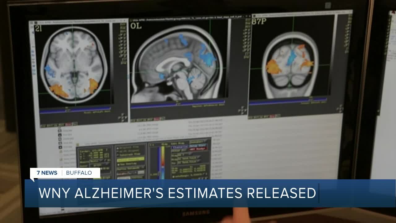 Where in Western New York is Alzheimer’s most prevalent?