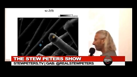 ☢(Must See) The Truth about JAB - Scientist Discovers Parasites w/Hatching Eggs