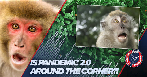 Monkeypox | Is Pandemic 2.0 Moments Away?!!