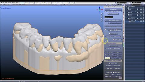 Raising the occlusion.