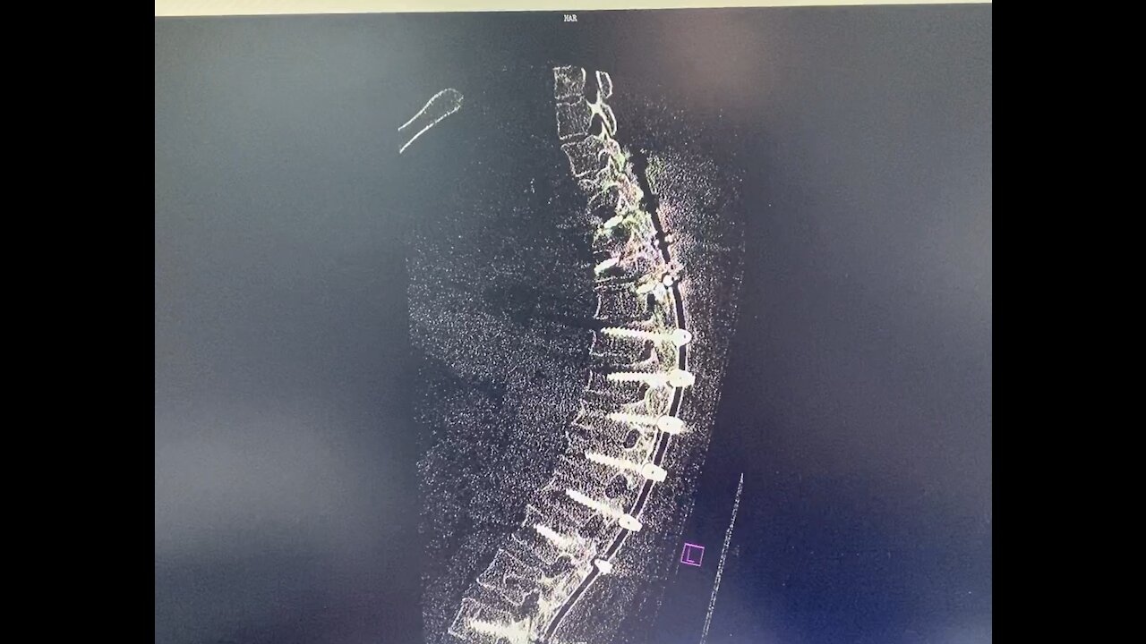 Take a look inside my body back in 2014