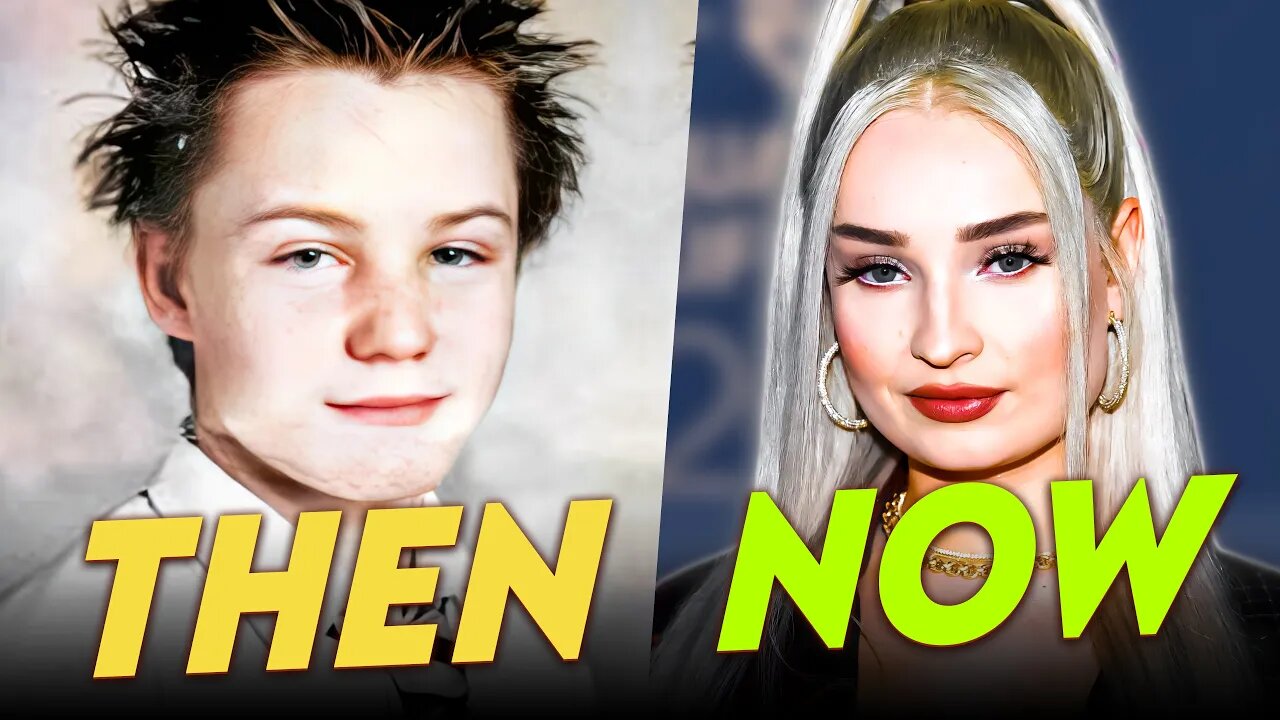 Kim Petras | Before & After | Her Full Transformation