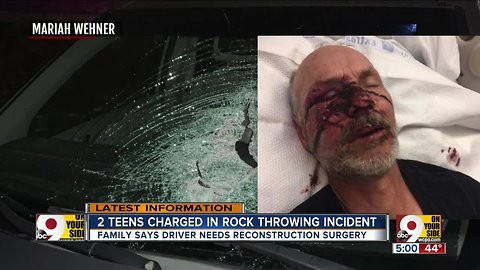 Two teens charged in Burlington rock-throwing