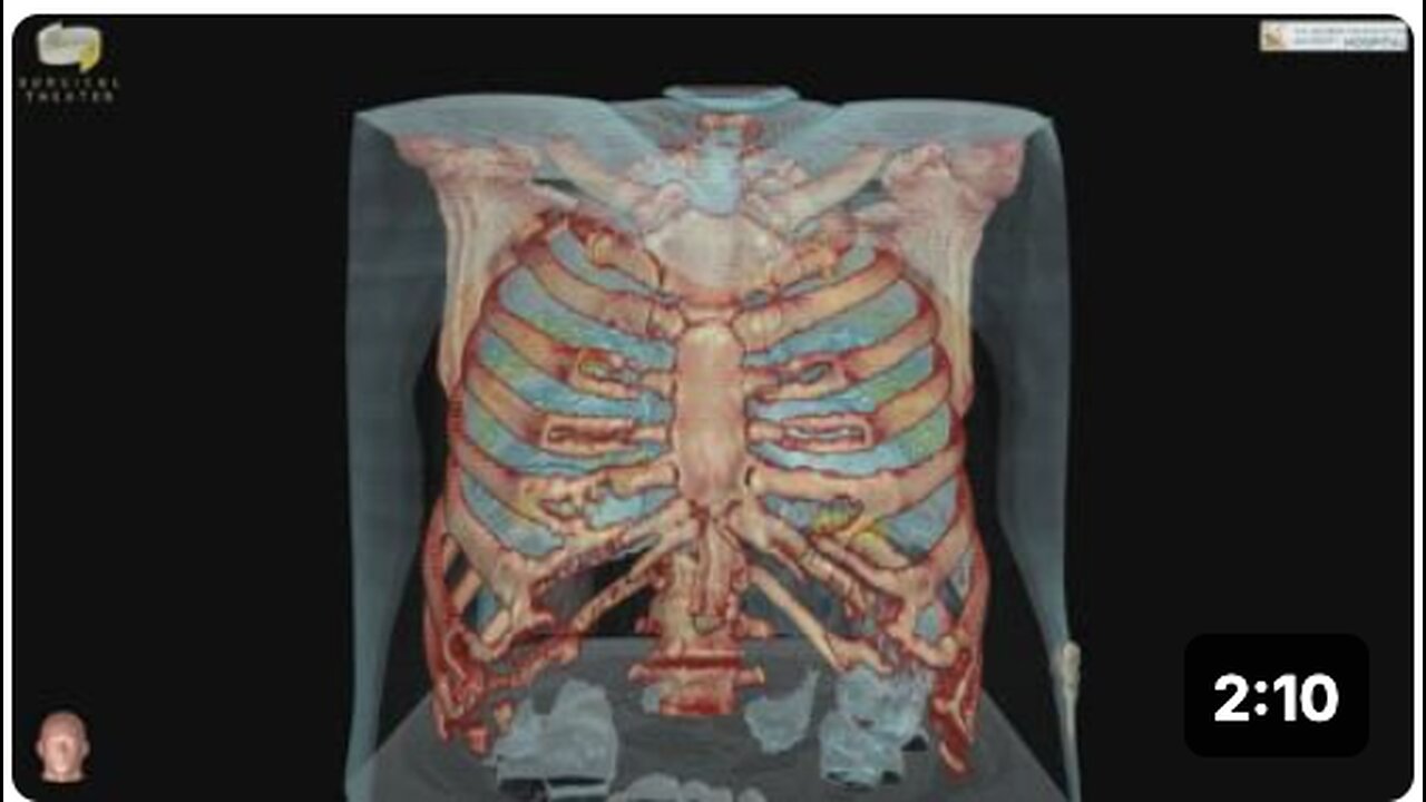 Dr. Mortman GWUH - Lung Damage from COVID-19