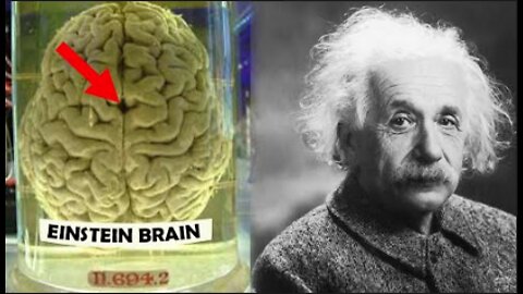 How Einstein's Brain was Different ?