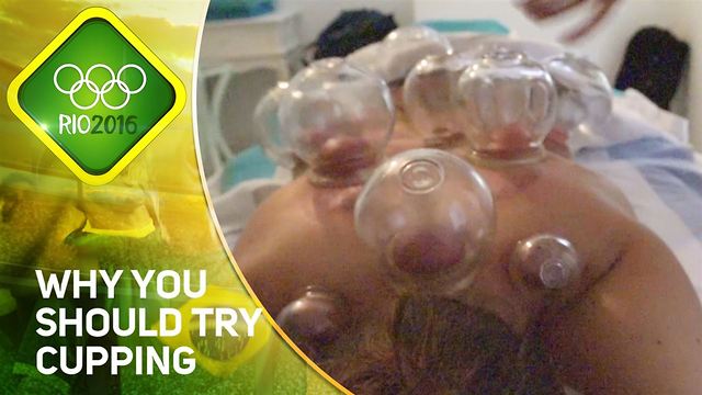 Rio 2016: Not just for Phelps! 5 reasons to try cupping