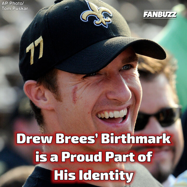 Drew Brees’ Birthmark is a Proud Part of His Identity