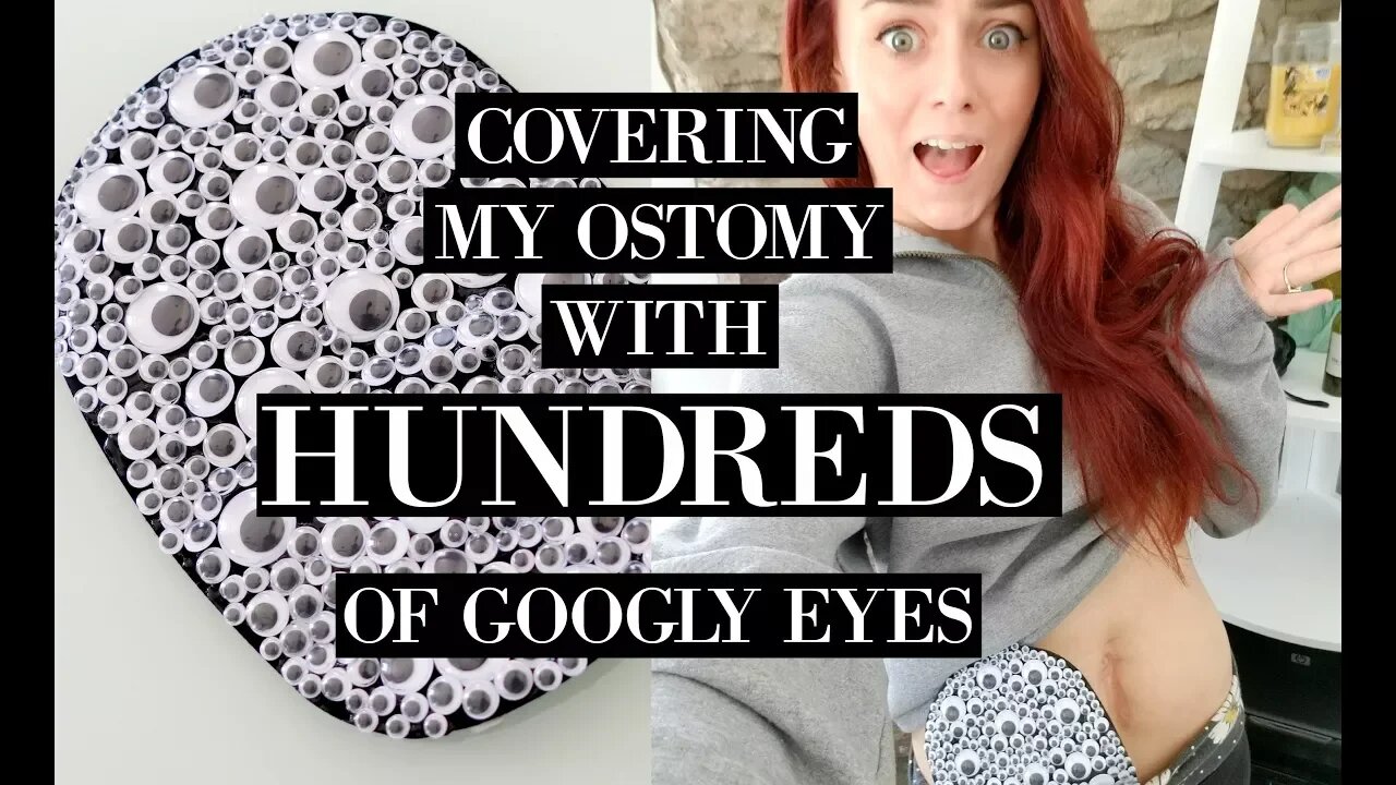 Covering my Ostomy with HUNDREDS of Googly Eyes| Let's Talk IBD