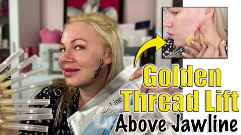 Golden Thread Lift Above the Jawline from Acecosm.com | Code Jessica10 Saves you Money!