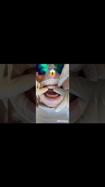 how to fix tooth gap in two minutes#shorts#fix#fast