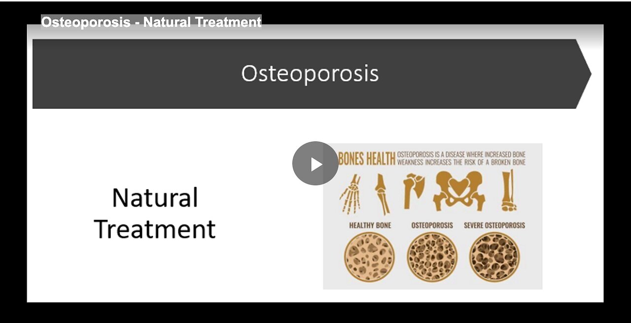 Osteoporosis - Natural Treatment
