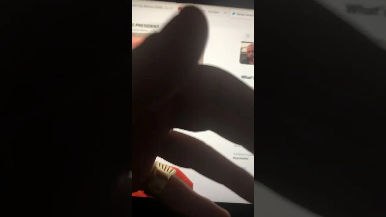 Boiling Tar Burns 🔥🔥🔥