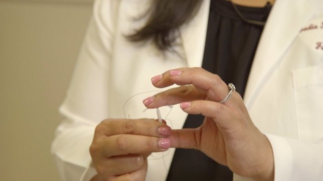 How IUDs Became One Of Doctors' Top Contraceptive Choices