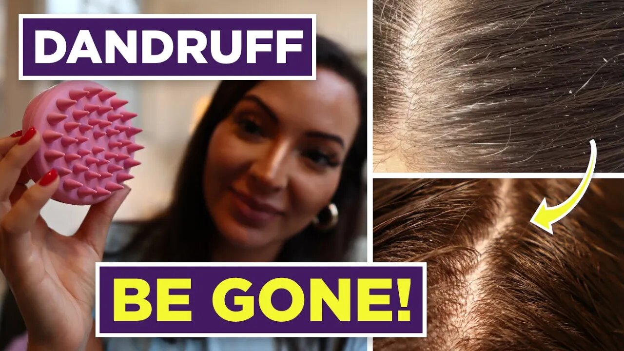 Discover the Miracle Scalp Brush that Will Transform Your Hair and Get Rid of Dandruff Forever!