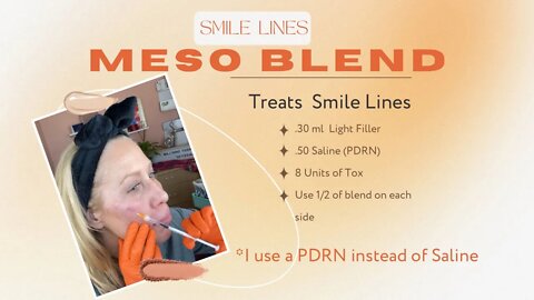 Soften Smile Lines with this Meso Blend 😍