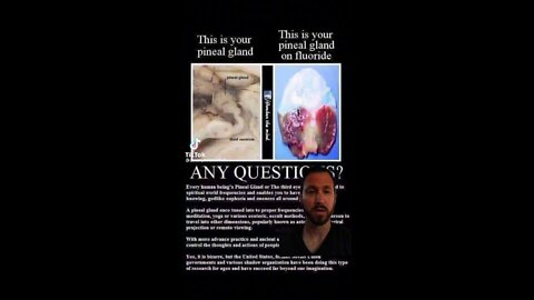 Your Pineal Gland is your Connection to the Source