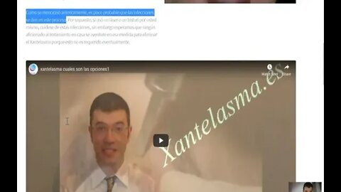 CÓMO QUITAR LOS XANTELASMAS EN CASA