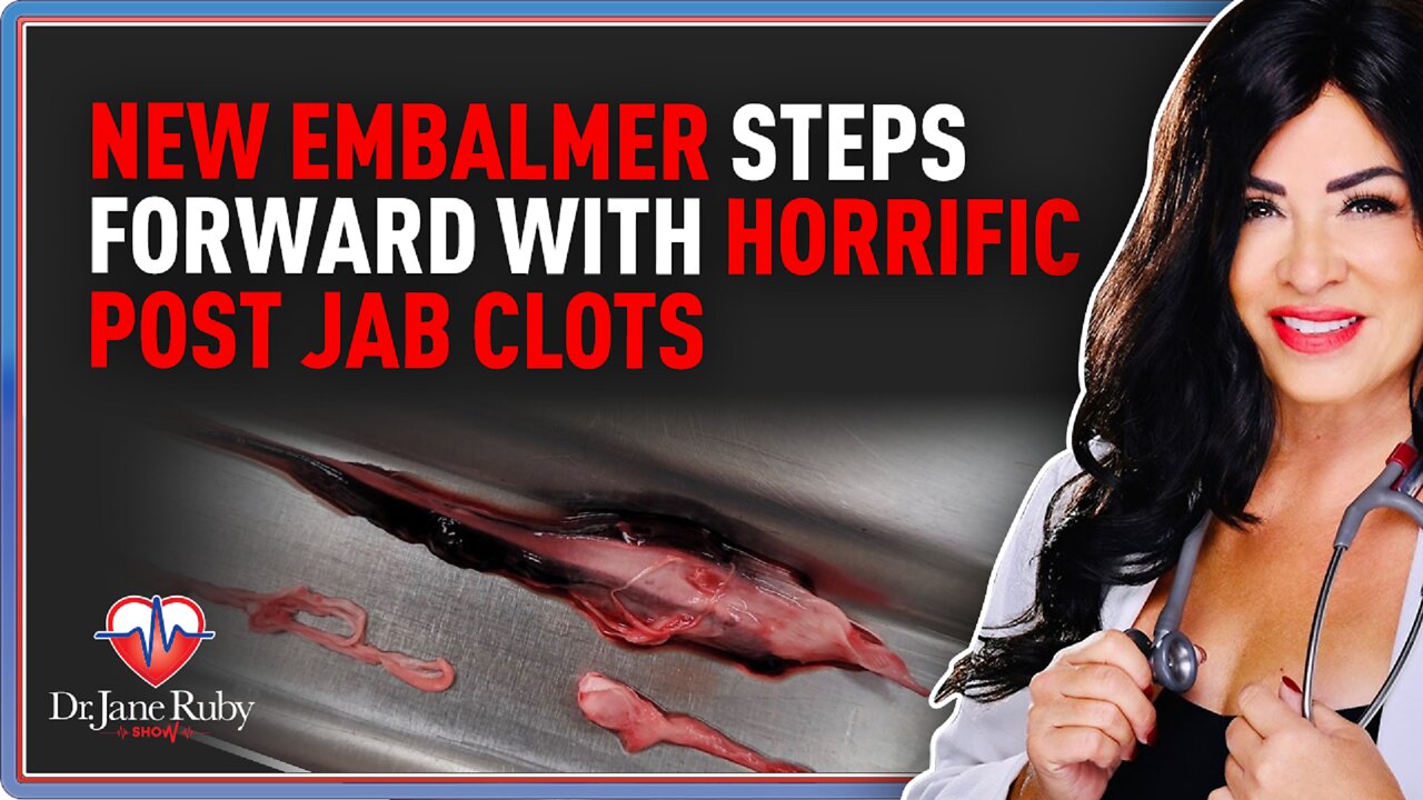 New Embalmer Steps Forward With Horrific Post Jab Clots