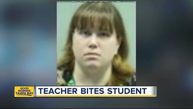 Preschool teacher accused of biting 2-year-old's face