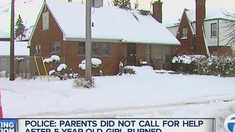 Police investigate after 5-year-old is burned