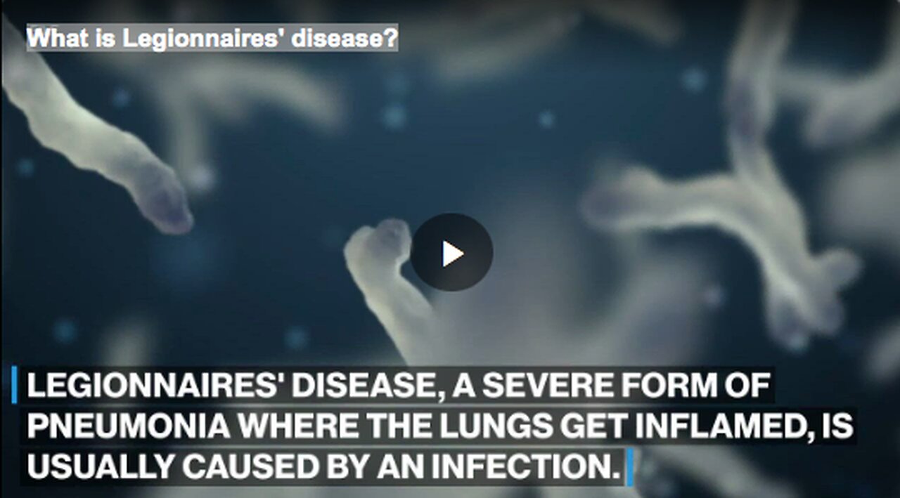 What is Legionnaires' disease?