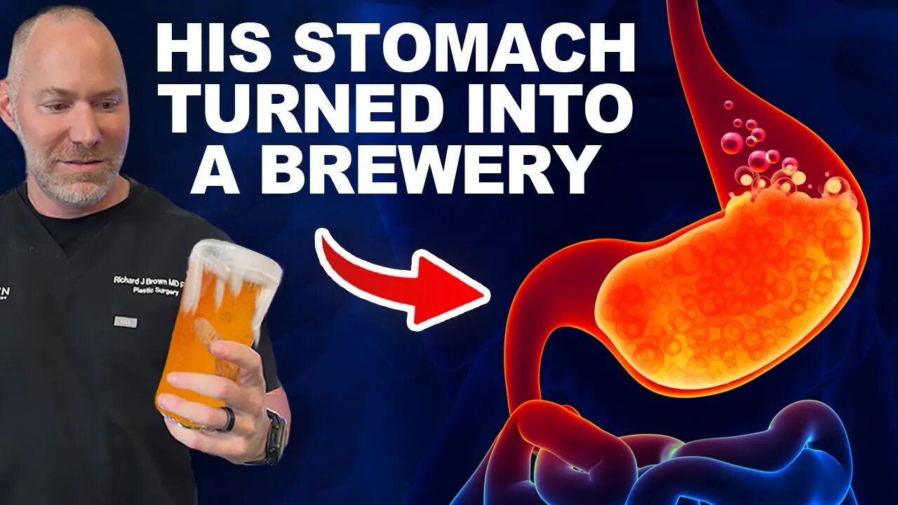 His Body Became a Brewery!