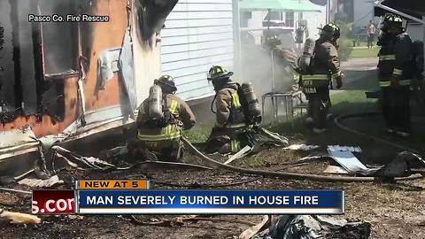 Man severely burned in Pasco house fire