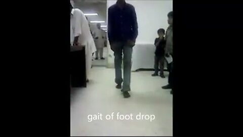 Gait in Paediactrics examination