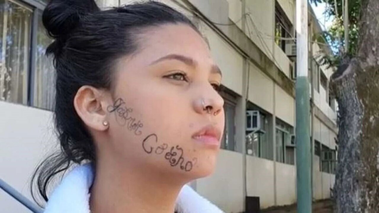 Covardia:Jovem é tatuada à força no rosto com o nome do ex-namorado