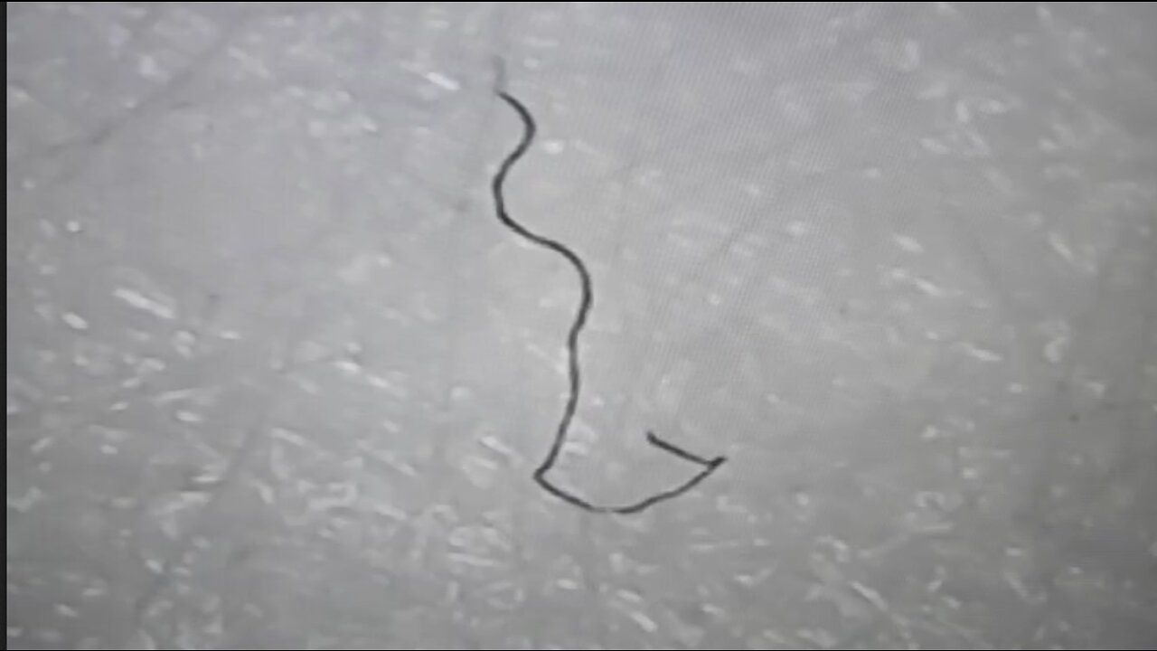 31.01.2022 - Parasites in face mask