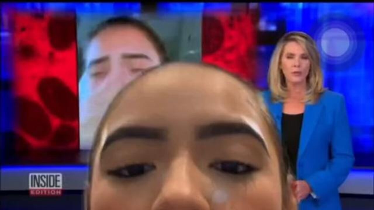 MONKEYPOX MAIN STREAM MEDIA [EXPOSED] ILLEGALLY USING SOMEONES CONTENT!!!
