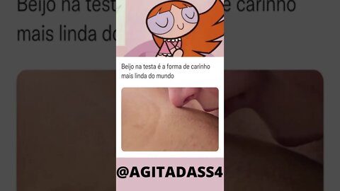 Beijo na testa é a forma de carinho mais linda do mundo