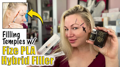 Fize PLA (Sculptra Dupe) in Temples with Cannula from Acecosm.com | Code Jessica10 Saves you Money!