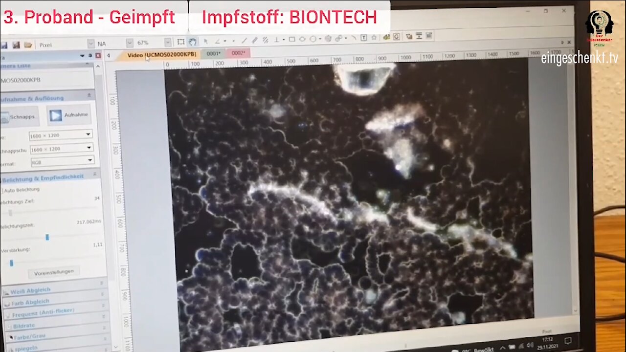 😳 Blutproben GEIMPFT // UNGEIMPFT 😳