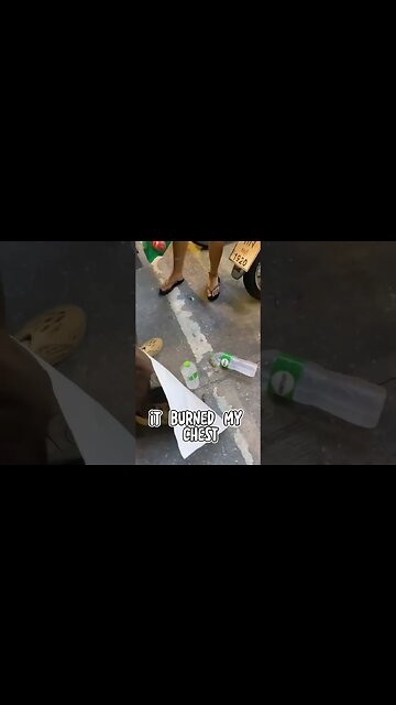 Bug Burns Human Chest!