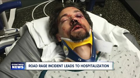 Father of four seriously hurt in Cheektowaga road rage incident