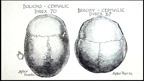 Swiss have Khazarian Brachycephalic Craniometry Cephalometry from Central Asia Mongolia