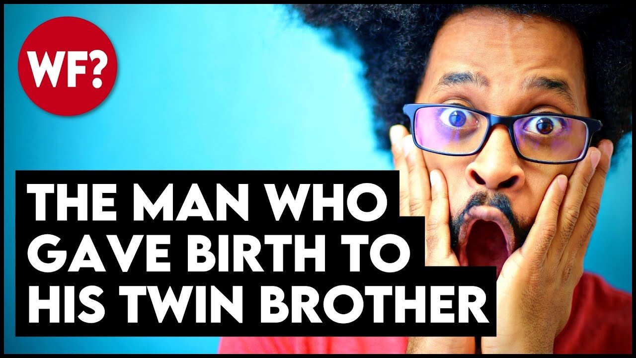 The Man Who Gave Birth -- To His TWIN