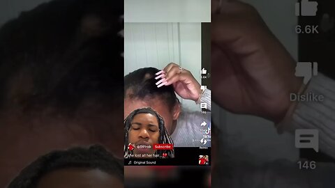 Lost hair from 💉! I know a few who went through the same thing.