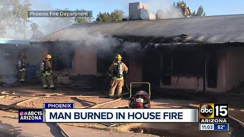 Man burned in Phoenix house fire