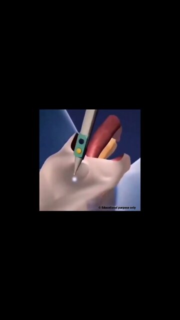 Male to Female Transformation... Any thoughts on this? #science #shorts #male #female