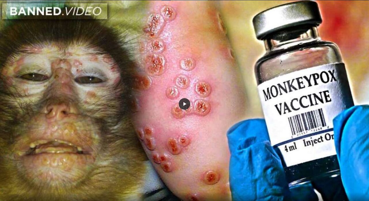 REPORT: How Monkeypox Was Planned For Pandemic