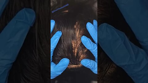 Scalp Check & Treatment ~ASMR No Talking #asmr #asmrsounds #anon7mousasmr #shorts