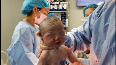 Doctor Holds Newborn Baby By The Head