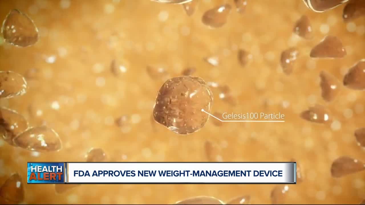 Ask Dr. Nandi: The FDA just approved a new prescription weight-management device. Here's how it works