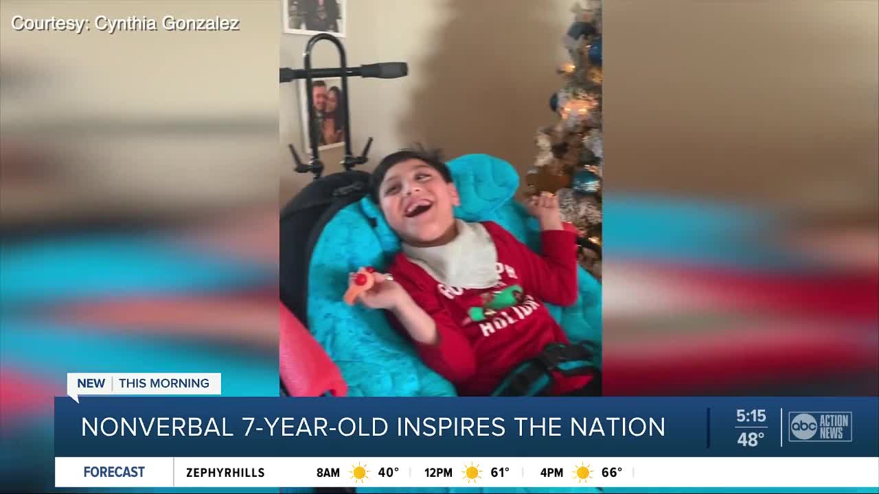 Palmetto boy with cerebral palsy gets national love for his spirit and million-dollar-smile